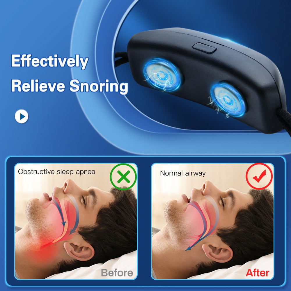 Smart Anti-Snoring & Sleep Apnea Device – Intelligent Muscle Stimulation Technology