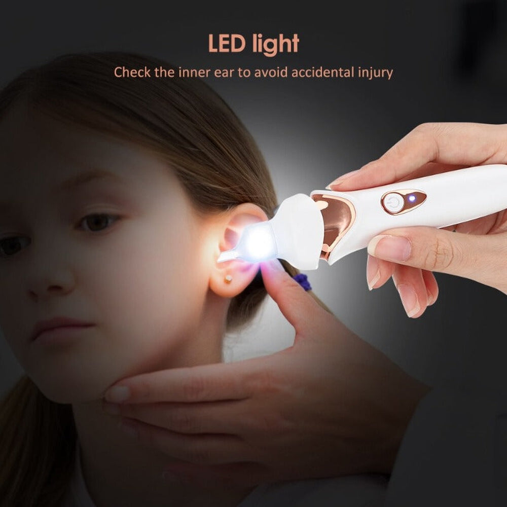 ClearEar LED Earwax Remover